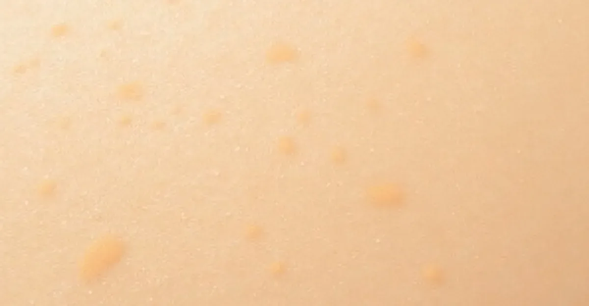 Zważony Podkład na Twarzy – Jak Go Uniknąć i Poprawić?